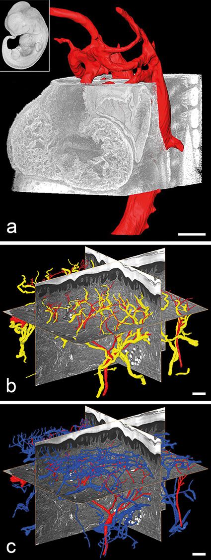 Hrem High Resolution Episcopic Microscopy Wiley Analytical