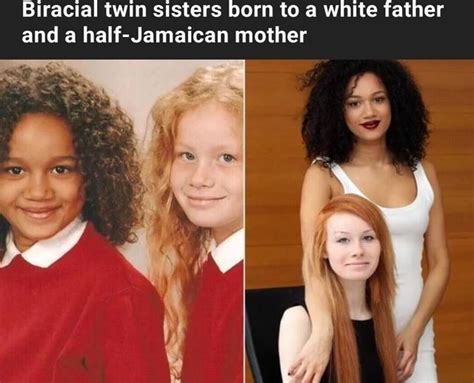 Biracial Twin Sisters Born To A White Father And Half Jamaican Mother