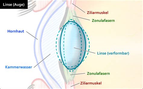 Augenlinse Funktion OP