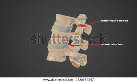 Neural Foramina Images Stock Photos Vectors Shutterstock