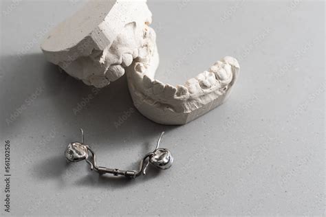 Plaster Models Of Dental Prostheses Demonstration Models Of Dentures