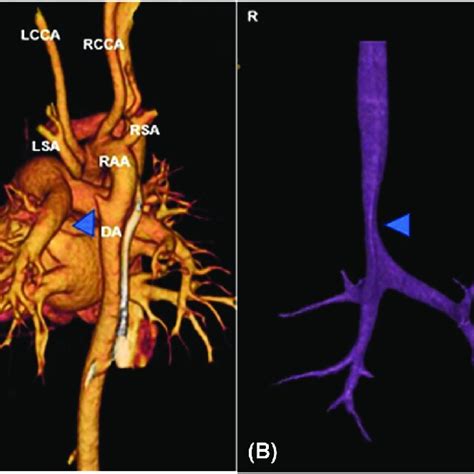 A Three Dimensional Reconstruction Images Described Anatomy Of