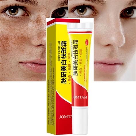 Effective Whitening Freckle Cream Remove Melasma Acne Spot Pigment