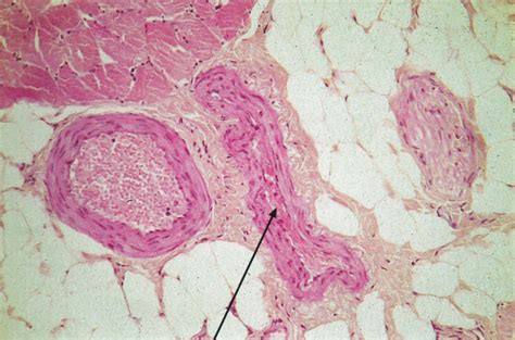 Fenestrated Capillary Histology