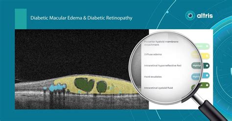 Oct Examination Vs Fundus Photography What To Choose