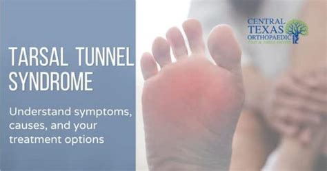 Understand The Symptoms And Causes Of Tarsal Tunnel Syndrome