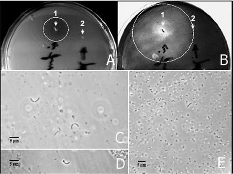 Halo Formation On Cgp Overlay Agar Plates Caused By Extracellular Download Scientific Diagram