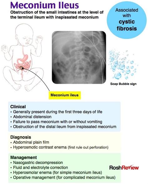 Meconium Ileus | Emergency nursing, Exam, Pediatrics