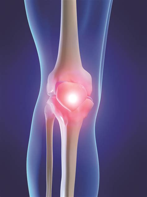 Knee Injury - Pulse Sports Therapy Pulse Sports Therapy