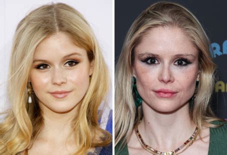 Erin Moriarty Plastic Surgery: Is That Why She Looks Different?