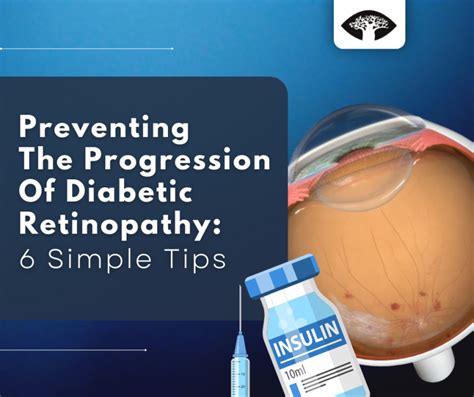 6 Tips To Prevent The Progression Of Diabetic Retinopathy Dr Roelof Cronje