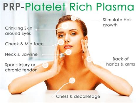 Platelet Rich Plasma Prp Scnmc Integrative Wellness