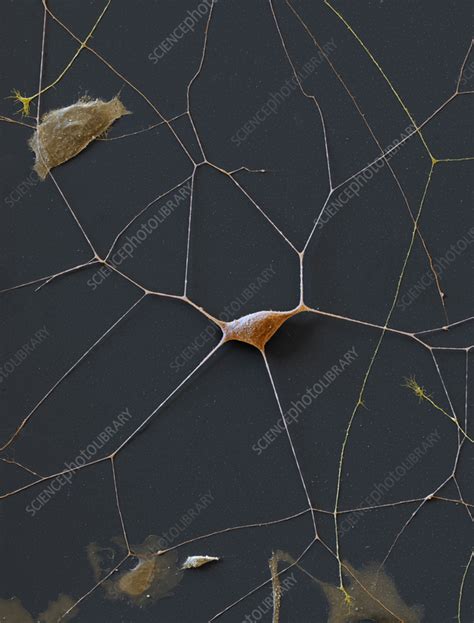 Trigeminal Ganglion Neuron Sem Stock Image C Science