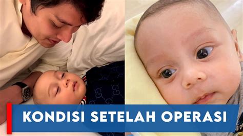 Rizky Billar Ungkap Kondisi Putranya Baby L Setelah Operasi Hernia