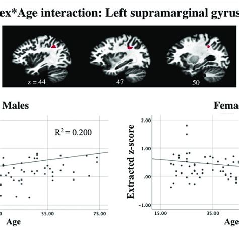 Linear Mixed Effects Model Revealed A An Interaction Between Sex