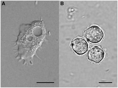 Acanthamoeba Trophozoite