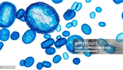 2,295 Smallpox Stock Photos, High-Res Pictures, and Images - Getty Images