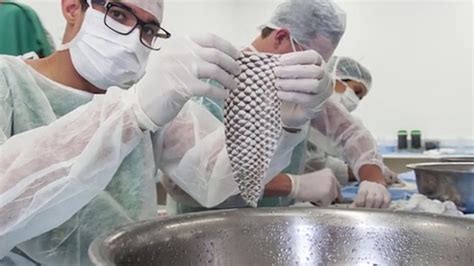 Una mujer transgénero se convirtió en la primera en recibir un implante de vagina hecho con piel