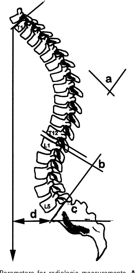 Figure 1 From Significance Of Chin Brow Vertical Angle In Correction Of