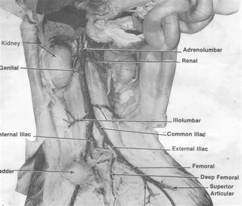 Diagram Carnation Dissection Diagram Wiringschema