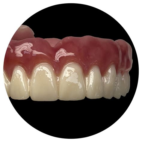 Smile Fusion | Fully Digital Dental Lab for Precision Prosthetics