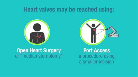 Types of Replacement Heart Valves | American Heart Association CPR ...