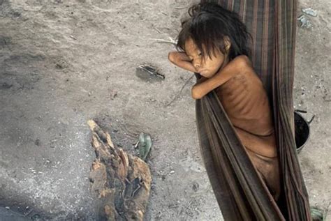 Pesando Kg Um Ano De Idade Beb Yanomami Morre De Desnutri O Em Rr