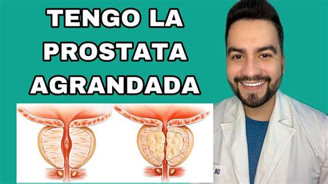 Que Es La Hiperplasia Prostatica Benigna Tengo Agrandada La Prostata