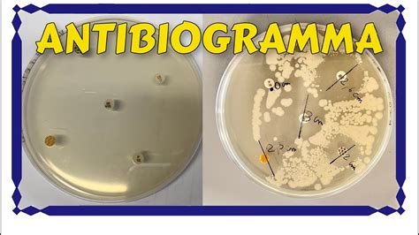 Come Fare Un Antibiogramma Con Metodica Kirby Bauer E Come