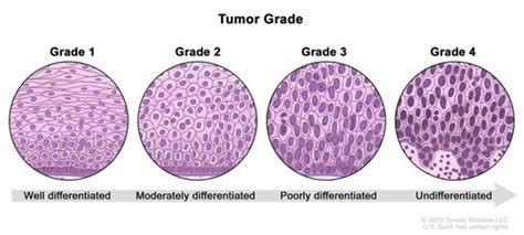 LECTURE 5 NEOPLASTIC DISEASE Flashcards Quizlet