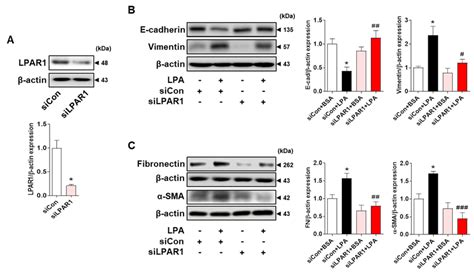 LPAR1 knockdown inhibited LPA−induced changes in the expression levels ... 
