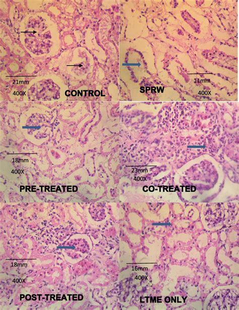 Nephrons Histopathology Changes On Rat Treated With Ltme In