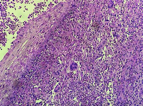 Histopathology Hematoxylin And Eosin Stain Original Magnification X