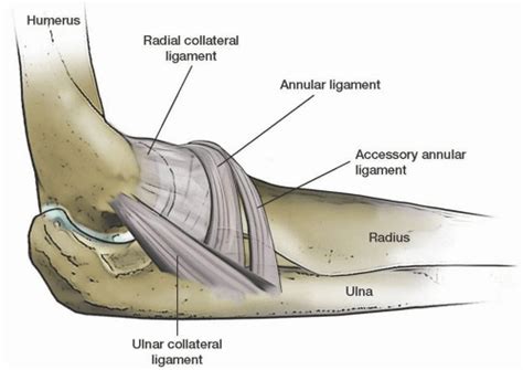 Open Treatment Of Lateral Epicondylitis Musculoskeletal Key