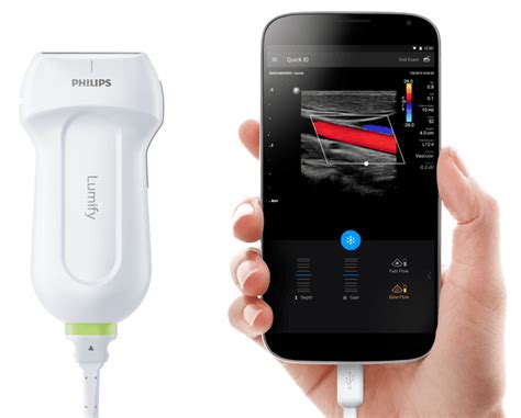 Philips Lumify Portable Ultrasound Machine