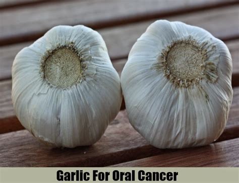 5 Top Home Remedies For Oral Cancer ~ Mzizi Mkavu