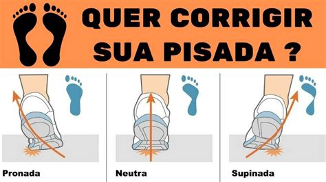 Pisada Pronada E Supinada RETOEDU