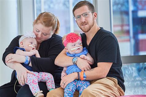 Formerly Conjoined Twins Erin And Abby Delaney Thriving Months After Separation Surgery