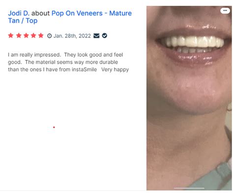 How Does Pop On Veneers Compare?