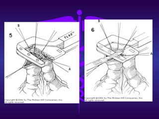 Anatom A Y Fisiolog A Del Colon Preparaci N Preoperatoria Ppt