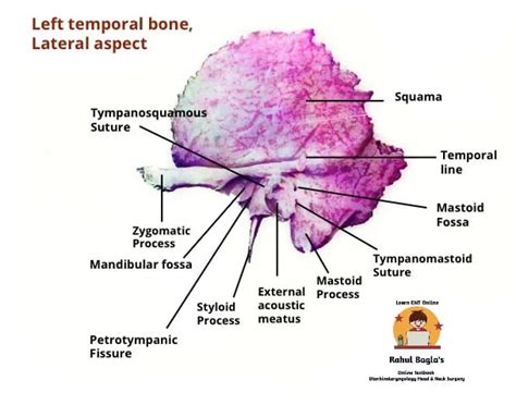 Anatomy Of Temporal Bone Dr Rahul Bagla Ent Textbook