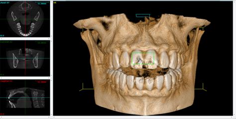 Cone Beam 3D Imaging In Metairie LA Smile Solutions DMD