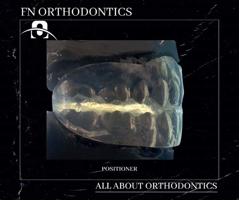 Positioner | FN Orthodontics