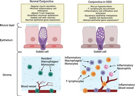 Frontiers Ocular Surface Inflammatory Disorders Osid A Collective Of Systemic Etiologies