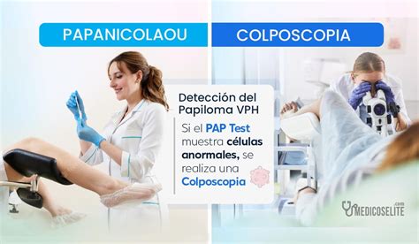 Diagnóstico Y Tratamientos Para El Papiloma Humano Vph Quito