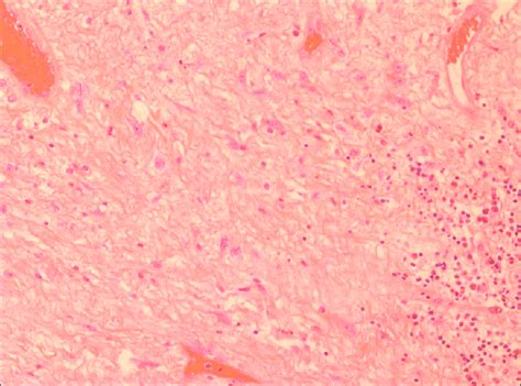 High Power Magnification Of The Dense Fibrous Connective Tissue With