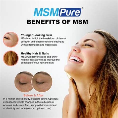 Maximum Strength MSM Skin and Facial Gel with Organic Aloe (8 oz ...
