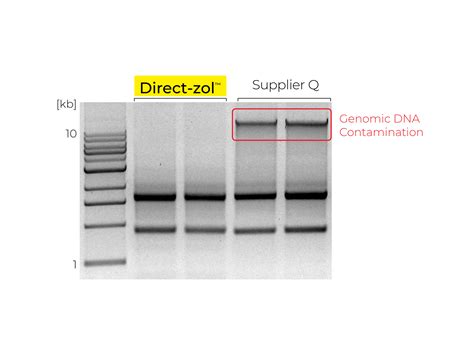 What Is Trizol Reagent Zymo Research Zymo Research International