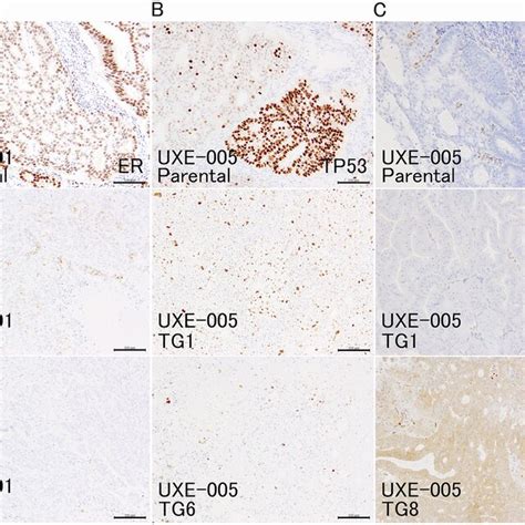 Immunohistochemical Findings Of Parental Tumors And PDX A