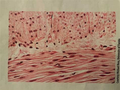 Histology Pics, ANATOMY, GABBY Flashcards | Quizlet